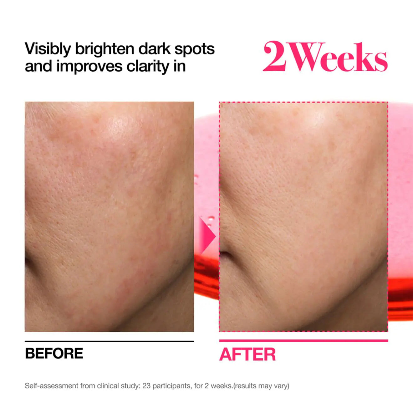 Niacinamide 10 + TXA 4 Serum